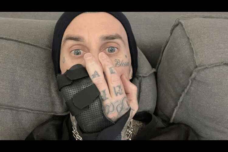 Blink-182’s Travis Barker having surgery on ring finger ahead of world tour